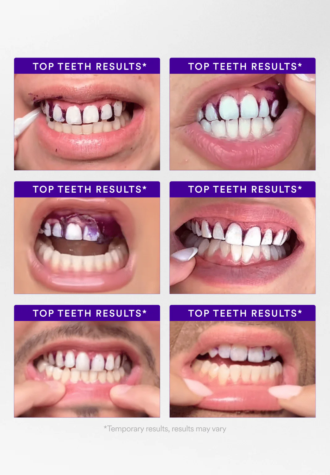V34 Whitening Strips - Image 4