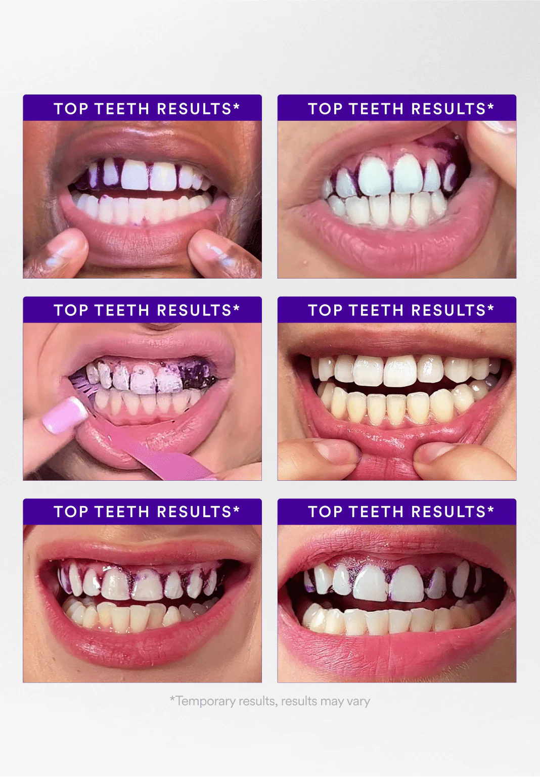 V34 Whitening Strips - Value Deal - Image 4